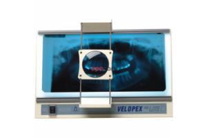 Velopex Hi Lite Viewer - стоматологический негатоскоп для интраоральных и панорамных рентгенограмм, с лупой